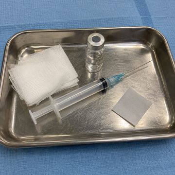 A cortisone injection tray with a syringe and vial
