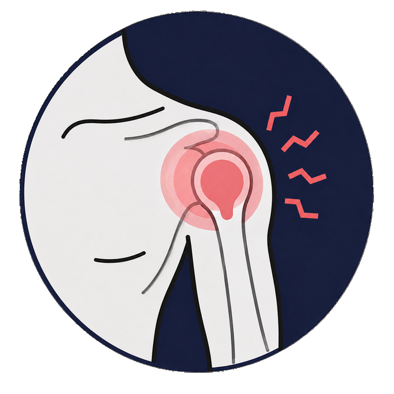 Raideur arthritique